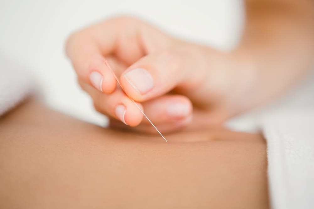 Considere a acupunctura para a gestão da dor